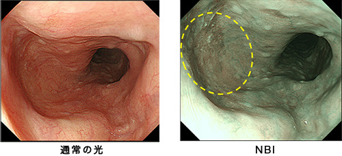 胃内視鏡検査（胃カメラ）2
