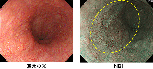 胃内視鏡検査（胃カメラ）3